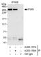 Inositol 1,4,5-Trisphosphate Receptor Type 1 antibody, A302-158A, Bethyl Labs, Immunoprecipitation image 