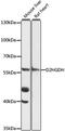 D-2-Hydroxyglutarate Dehydrogenase antibody, 16-493, ProSci, Western Blot image 