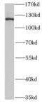 Staphylococcal Nuclease And Tudor Domain Containing 1 antibody, FNab08063, FineTest, Western Blot image 