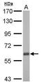 USP14 antibody, GTX115186, GeneTex, Western Blot image 
