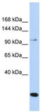 Short transient receptor potential channel 6 antibody, TA344231, Origene, Western Blot image 