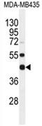 POC1 Centriolar Protein B antibody, AP54549PU-N, Origene, Western Blot image 