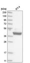 CAMP Responsive Element Binding Protein 3 antibody, HPA030978, Atlas Antibodies, Western Blot image 