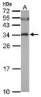 Eukaryotic Translation Elongation Factor 1 Beta 2 antibody, GTX106535, GeneTex, Western Blot image 