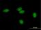 FLJ35220 antibody, H00284131-B01P, Novus Biologicals, Immunocytochemistry image 