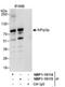 Pre-MRNA Processing Factor 3 antibody, NBP1-19114, Novus Biologicals, Immunoprecipitation image 