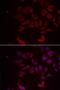 Ribosomal Protein L11 antibody, LS-C334693, Lifespan Biosciences, Immunofluorescence image 