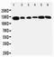 Telomerase Reverse Transcriptase antibody, PA5-80105, Invitrogen Antibodies, Western Blot image 