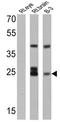 Recoverin antibody, GTX79211, GeneTex, Western Blot image 