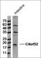 Small Integral Membrane Protein 20 antibody, orb156075, Biorbyt, Western Blot image 