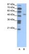 Forkhead Box D2 antibody, orb329617, Biorbyt, Western Blot image 