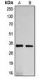 DnaJ Heat Shock Protein Family (Hsp40) Member C17 antibody, orb215210, Biorbyt, Western Blot image 