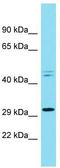 Rho-related GTP-binding protein RhoE antibody, TA342871, Origene, Western Blot image 
