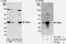 Potassium Channel Tetramerization Domain Containing 12 antibody, A303-471A, Bethyl Labs, Immunoprecipitation image 