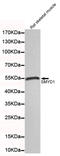 SET And MYND Domain Containing 1 antibody, STJ99052, St John