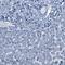 NAC Alpha Domain Containing antibody, PA5-54294, Invitrogen Antibodies, Immunohistochemistry frozen image 