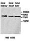 Zinc finger BED domain-containing protein 1 antibody, orb77615, Biorbyt, Western Blot image 