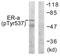Estrogen Receptor 1 antibody, TA311733, Origene, Western Blot image 