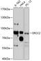 ERCC Excision Repair 2, TFIIH Core Complex Helicase Subunit antibody, 14-917, ProSci, Western Blot image 