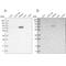 Leucine Rich Repeat Containing 45 antibody, NBP1-93510, Novus Biologicals, Western Blot image 