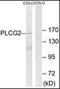 Phospholipase C Gamma 2 antibody, orb95549, Biorbyt, Western Blot image 