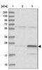 Ribosomal Protein L13a antibody, NBP1-92345, Novus Biologicals, Western Blot image 