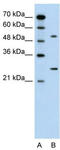 Calcium Voltage-Gated Channel Auxiliary Subunit Beta 1 antibody, TA338797, Origene, Western Blot image 