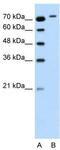 Rho Related BTB Domain Containing 1 antibody, TA346261, Origene, Western Blot image 