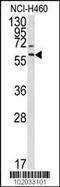 Matrix Metallopeptidase 17 antibody, 62-174, ProSci, Western Blot image 