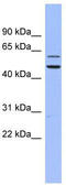 H/ACA ribonucleoprotein complex subunit 4 antibody, TA345774, Origene, Western Blot image 