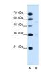 Major Facilitator Superfamily Domain Containing 12 antibody, NBP1-91591, Novus Biologicals, Western Blot image 