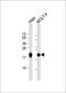 Ribosomal Protein L18a antibody, GTX80536, GeneTex, Western Blot image 