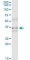 Musashi RNA Binding Protein 2 antibody, MA5-22987, Invitrogen Antibodies, Immunoprecipitation image 