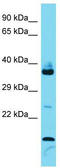 Family With Sequence Similarity 133 Member B antibody, TA334979, Origene, Western Blot image 
