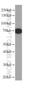 Albumin antibody, 66201-1-Ig, Proteintech Group, Western Blot image 