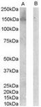 Receptor tyrosine-protein kinase erbB-3 antibody, TA303054, Origene, Western Blot image 