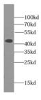 HBZ antibody, FNab03780, FineTest, Western Blot image 