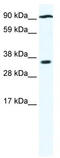 Poly(ADP-Ribose) Polymerase Family Member 16 antibody, TA334256, Origene, Western Blot image 