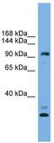 Coiled-Coil Domain Containing 110 antibody, TA329795, Origene, Western Blot image 