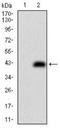 CD74 Molecule antibody, NBP2-37342, Novus Biologicals, Western Blot image 