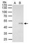 Elongator Acetyltransferase Complex Subunit 4 antibody, GTX111748, GeneTex, Immunoprecipitation image 