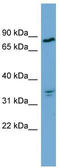 Acylaminoacyl-Peptide Hydrolase antibody, TA346558, Origene, Western Blot image 