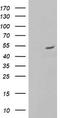 ALG2 Alpha-1,3/1,6-Mannosyltransferase antibody, TA504218, Origene, Western Blot image 