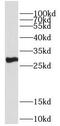 2,4-Dienoyl-CoA Reductase 2 antibody, FNab02322, FineTest, Western Blot image 