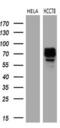 ROS Proto-Oncogene 1, Receptor Tyrosine Kinase antibody, M04186, Boster Biological Technology, Western Blot image 