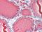 Thyroglobulin antibody, orb86665, Biorbyt, Immunohistochemistry paraffin image 