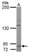 Discoidin Domain Receptor Tyrosine Kinase 2 antibody, PA5-27752, Invitrogen Antibodies, Western Blot image 