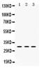 Protein Kinase AMP-Activated Non-Catalytic Subunit Beta 2 antibody, PB9739, Boster Biological Technology, Western Blot image 
