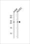 Dickkopf WNT Signaling Pathway Inhibitor 4 antibody, LS-C167429, Lifespan Biosciences, Western Blot image 