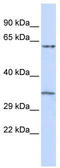 Tripartite Motif Containing 8 antibody, TA337258, Origene, Western Blot image 